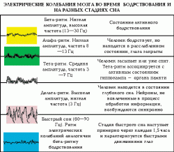 ЭЭГ.gif